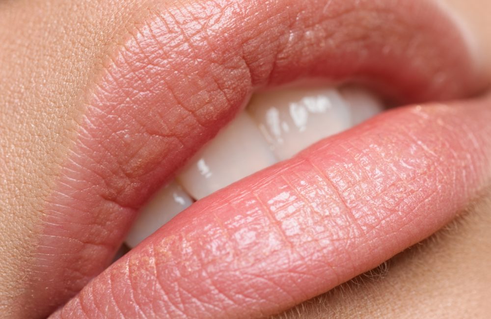 Labios