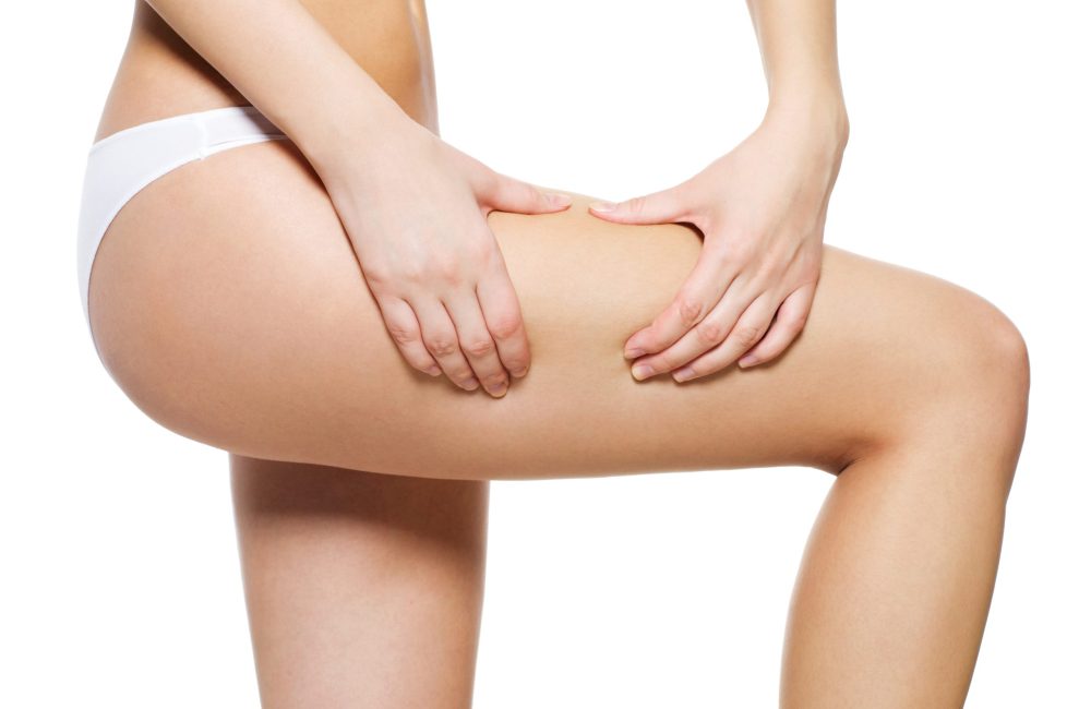 Female squeezes cellulite skin on her legs - close-up shot on white background