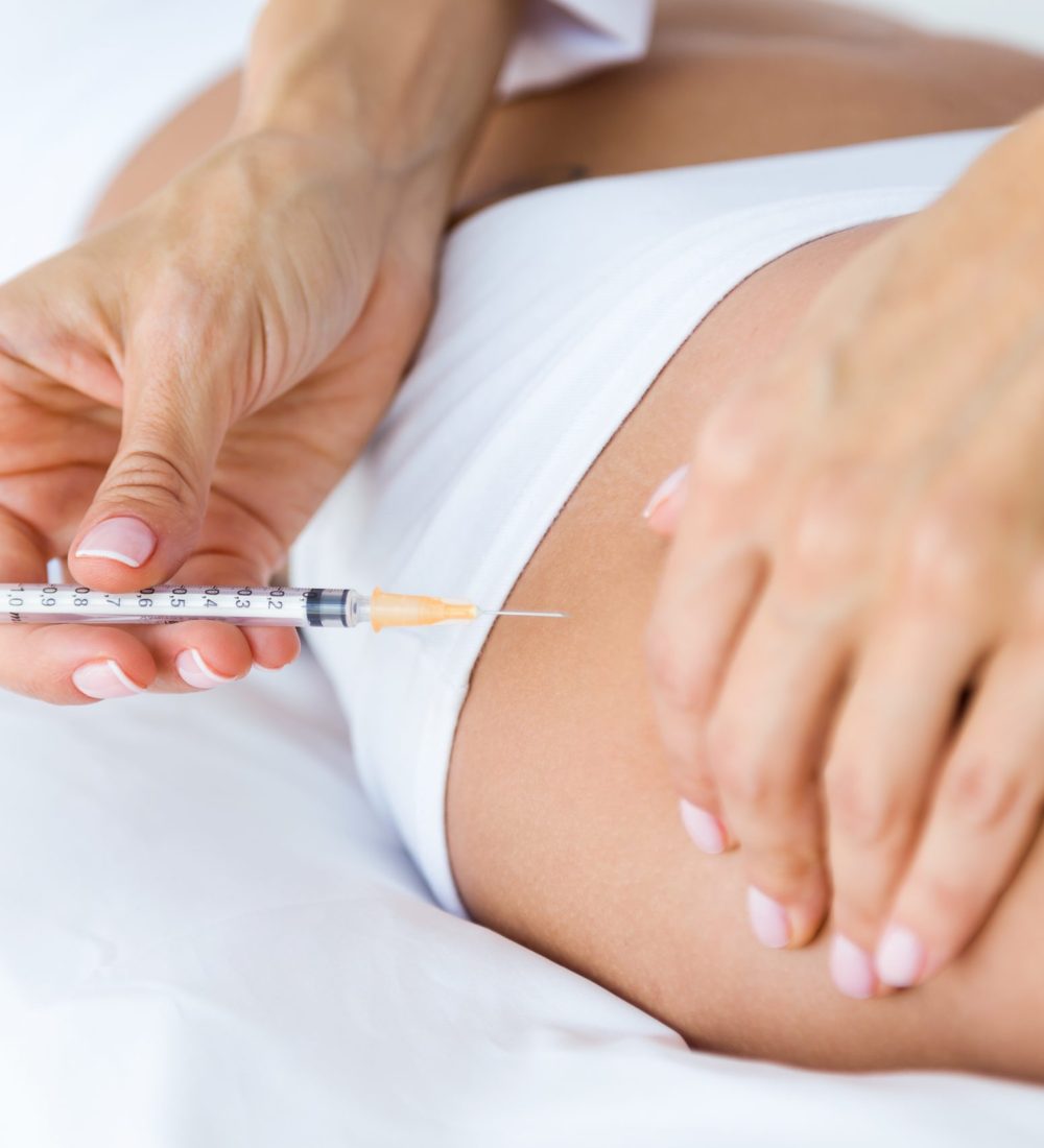 microneedling marbella